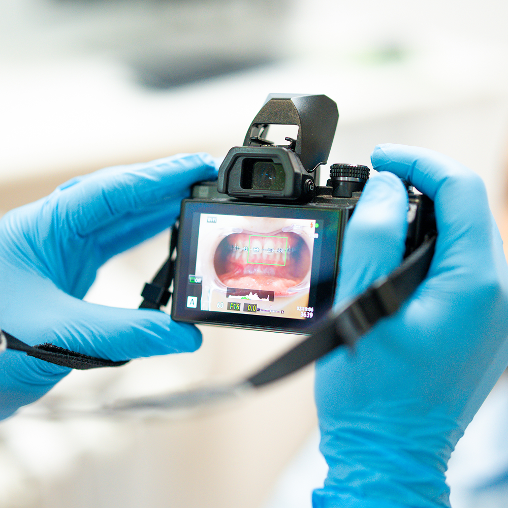 Photographies orthodontiques